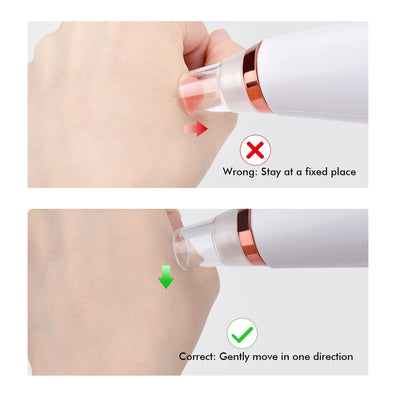 DermaPro fjern hudormer, fet hud og sorte prikker